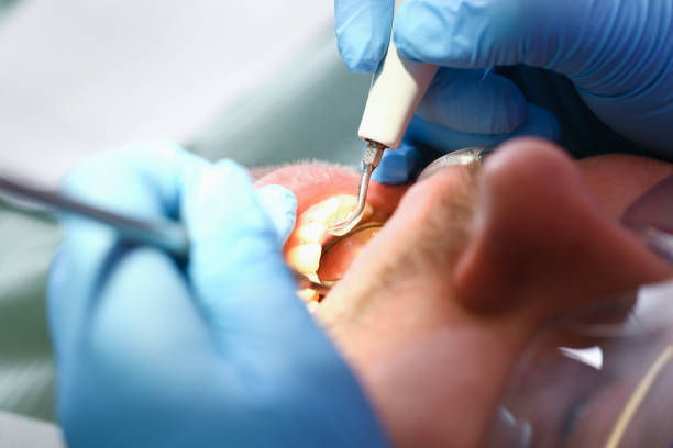 Best Walk-In Emergency Dentist in Country Squire Lakes, IN